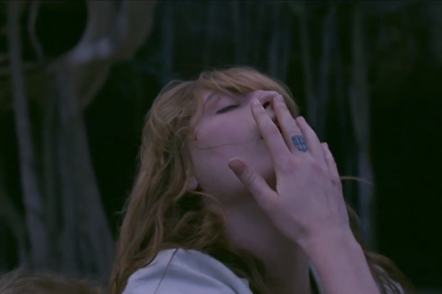Florence Welch broke her foot while playing Coachella