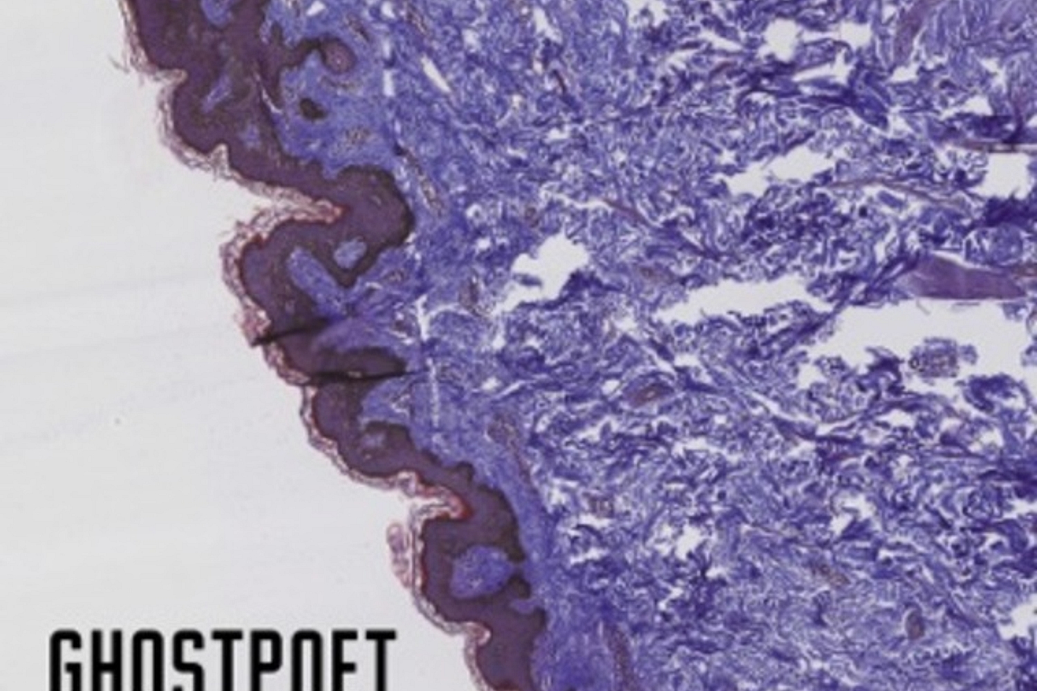 Ghostpoet - Shedding Skin